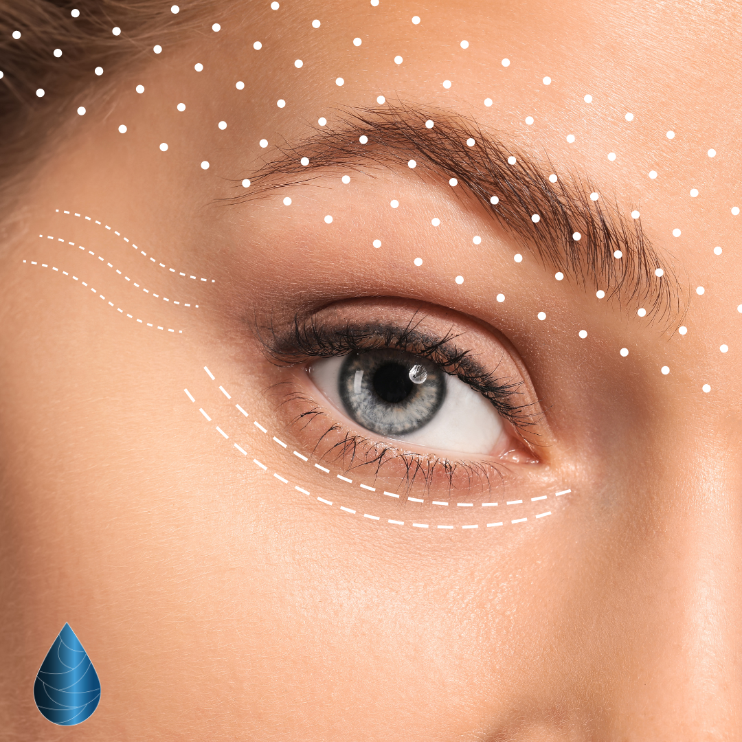 Soin contour des yeux Le Cannet