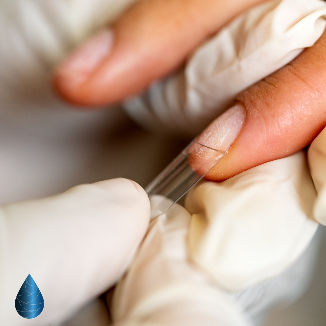 Réparation d'un ongle cassé Le Cannet