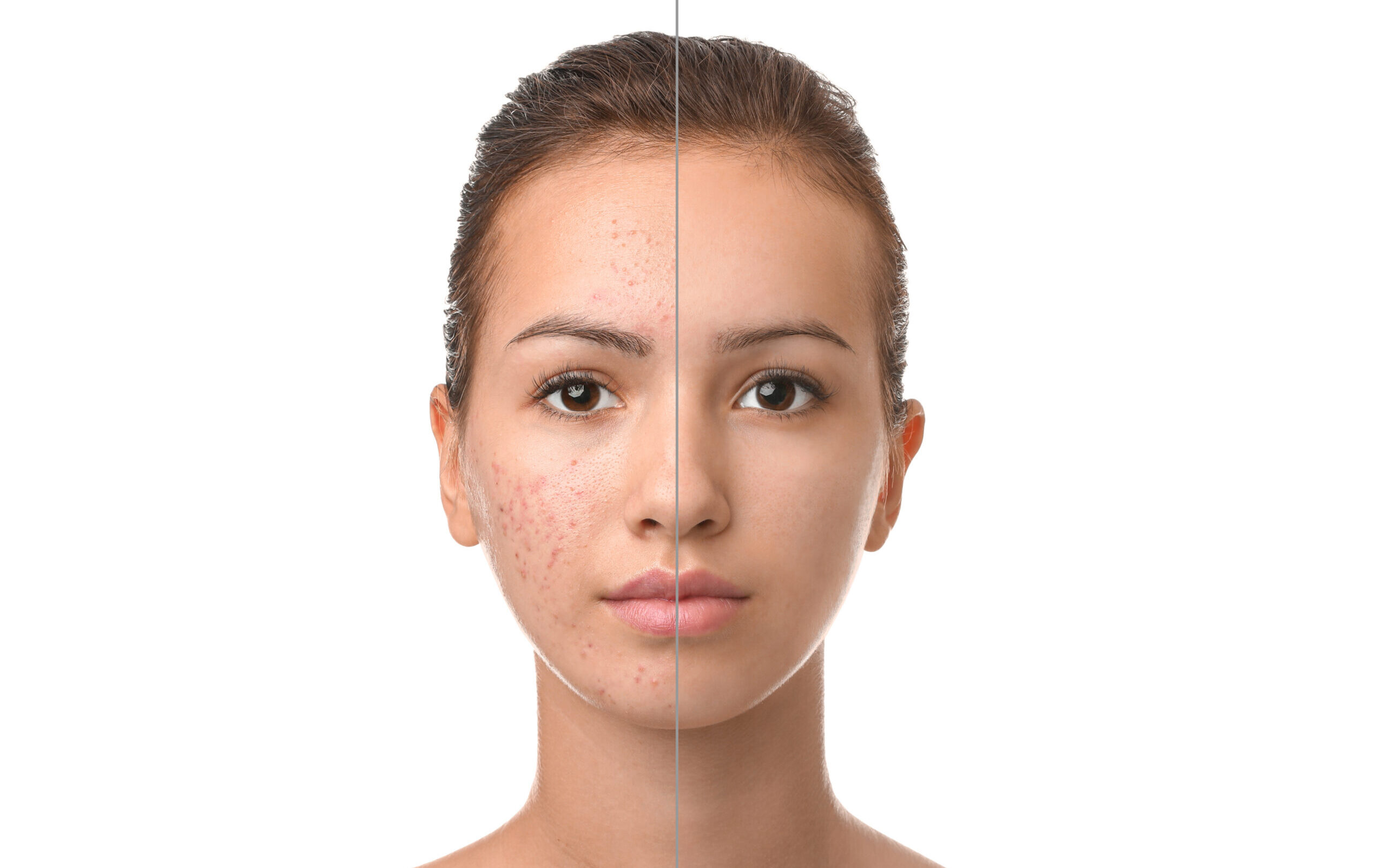 Cure ciblée pour les peaux sujettes aux imperfections, inflammations ou déséquilibres persistants. Elle vise à réguler le terrain cutané et à rétablir un fonctionnement plus équilibré de la peau.